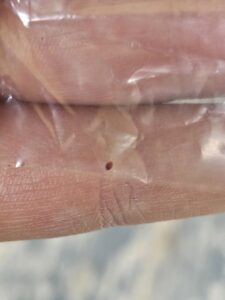 A small bedbug being examined on a person's finger under a clear plastic cover by Northwest Bedbug Company in Spokane, WA.