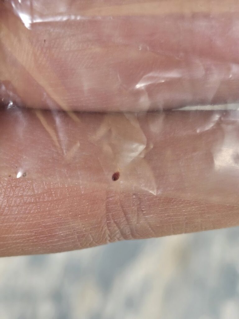A small bedbug being examined on a person's finger under a clear plastic cover by Northwest Bedbug Company in Spokane, WA.