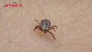 A close-up view of a tick on human skin, indicating a pest issue addressed by Otho's Pest Management in Randleman, NC