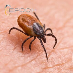 A close-up of a tick on human skin, a pest control service offered by Epoch Pest Solutions in Oklahoma City, OK.
