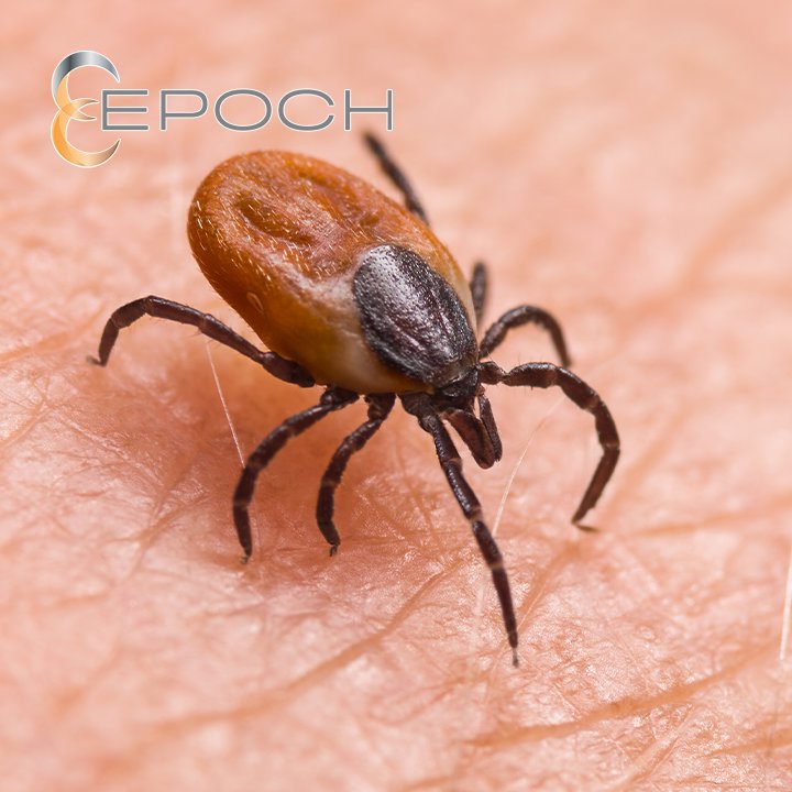 A close-up of a tick on human skin, a pest control service offered by Epoch Pest Solutions in Oklahoma City, OK.