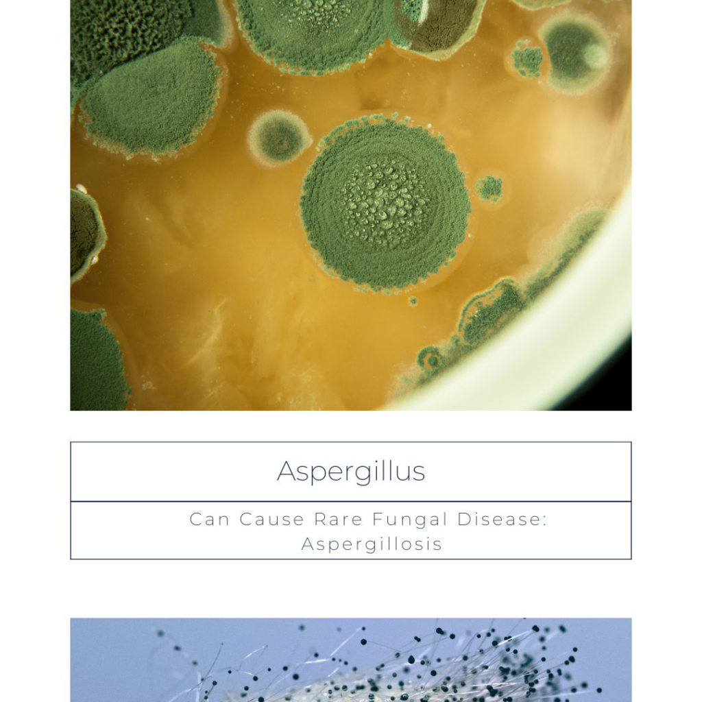 Close-up of Aspergillus mold growth, a common issue requiring a water damage specialist like Seaside Restoration Services in North Charleston, SC.
