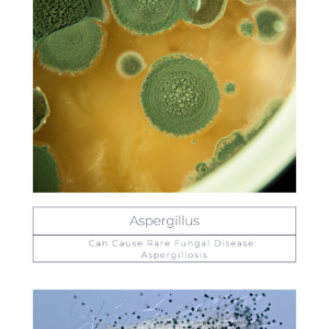 Close-up of Aspergillus mold growth, a common issue requiring a water damage specialist like Seaside Restoration Services in North Charleston, SC.